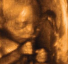 Mang thai tuần thứ 20 và sự phát triển của thai kỳ