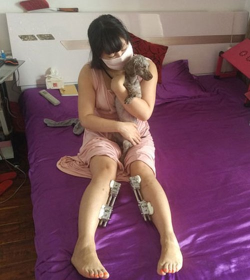 Tấn bi kịch của cô gái "dao kéo nhiều nhất Trung Quốc"