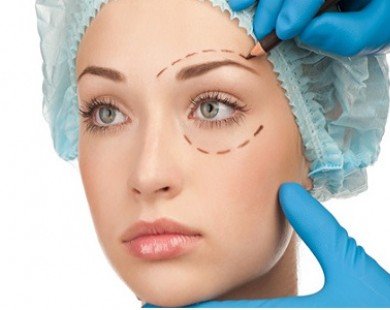 Chi tiết các bước phẫu thuật căng da mặt