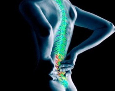Đau lưng – dấu hiệu của bệnh thoái hóa khớp