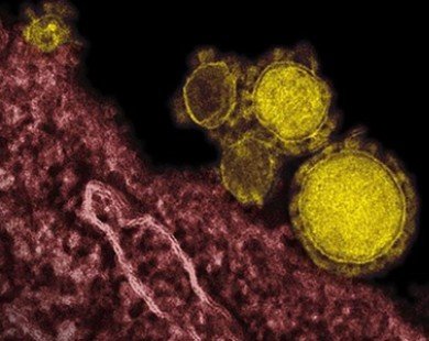 Thêm trường hợp nhiễm và tử vong do virus MERS