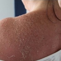 Gặp họa vì cuồng trắng da