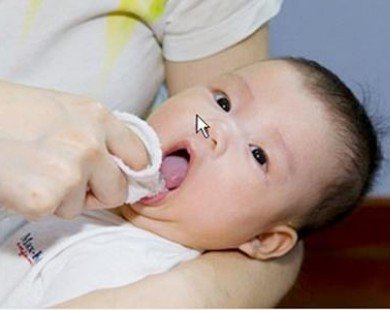 Phân biệt cặn sữa với tưa miệng ở trẻ