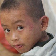 Nọc kiến ba khoang độc hơn rắn hổ