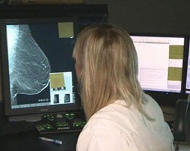Phát hiện ung thư vú sớm nhất bằng cách chụp X-quang 3D