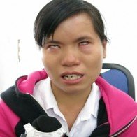 Một thí sinh khiếm thị được tuyển thẳng vào ĐH Đà Nẵng
