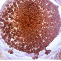 Đã loại bỏ thành công virút HIV khỏi tế bào người