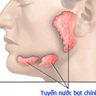 Bạn biết gì về ung thư tuyến nước bọt?