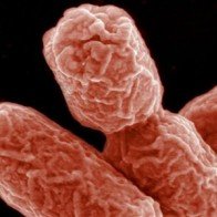 Phát hiện giá đỗ bẩn nhiễm vi khuẩn E. coli