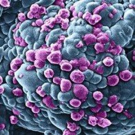 Các nhà khoa học Italy tìm ra cơ chế di căn ở bệnh ung thư vú