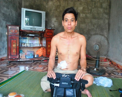Lạ kỳ người duy nhất ở Việt Nam sống nhờ sạc điện vào tim