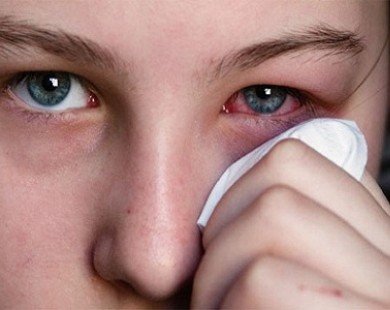 Tuyệt chiêu trị đau mắt đỏ hữu hiệu bằng khoai tây, mật ong