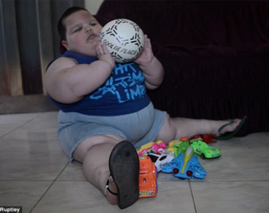 Bé trai mới 3 tuổi đã nặng 70kg do mắc bệnh không thể ngừng ăn