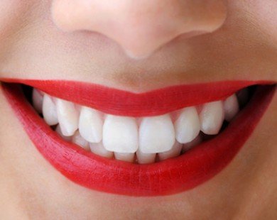 Cấp cứu hàm răng ngày càng ố vàng xấu xí