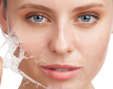 10 điều nhất định phải biết về da khô