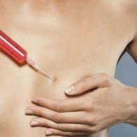 Nâng ngực tạm thời bằng nước muối ẩn chứa nhiều nguy cơ