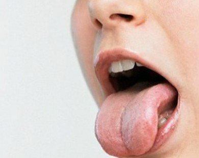 Nhận biết tình trạng sức khoẻ qua lưỡi