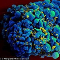 Tìm ra vắc xin phòng HIV? 