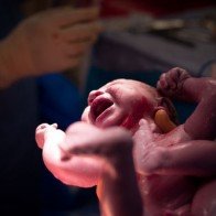 7 lý do 'ngớ ngẩn' khi chọn đẻ mổ