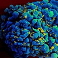 Đã tìm ra vắc-xin phòng HIV?