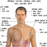 Dấu hiệu nhận biết và phòng tránh HIV/AIDS