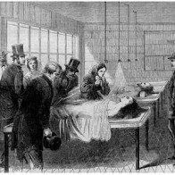 Những cách chữa bệnh khủng khiếp của thế kỷ 19