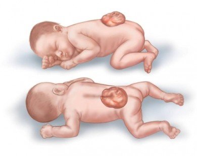 7 dị tật thường gặp ở thai nhi có thể phát hiện sớm