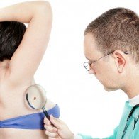 Nhận biết dấu hiệu ung thư da