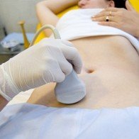 Ngứa âm đạo cảnh báo nguy cơ bị viêm lộ tuyến cổ tử cung