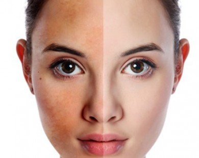 2 bước giúp cải thiện làn da không đều màu