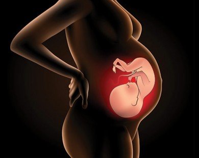 Những điều mẹ cần biết về thai chết lưu