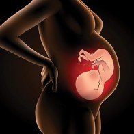 Những điều mẹ cần biết về thai chết lưu