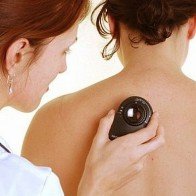 Có biểu hiện này bạn đã bị ung thư da