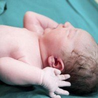 Trước khi sinh mổ chủ động cần chuẩn bị những gì