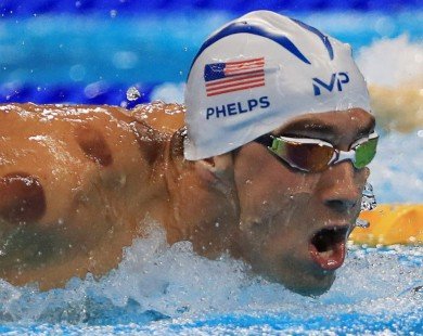 Michael Phelps giành HCV nhờ phương pháp cổ đại của Trung Quốc