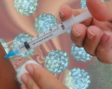Những điều bạn cần biết về virut HPV