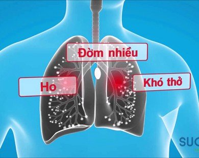 Dấu hiệu đặc trưng của tắc nghẽn phổi mạn tính