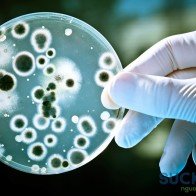 Đặc điểm bệnh lao phổi ở người cao tuổi