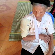 Những lưu ý khi điều trị gãy xương cho người cao tuổi