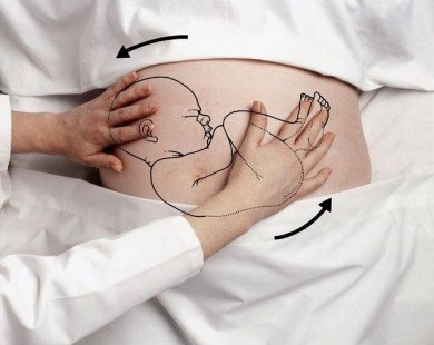 Mẹ bầu nên biết rõ hơn về ngôi thai ngược