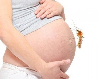 Một thai phụ nhiễm Zika sinh con không bị tật đầu nhỏ