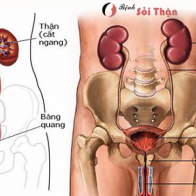 6 dấu hiệu cảnh báo sớm rối loạn chức năng thận ai cũng nên "thuộc lòng"