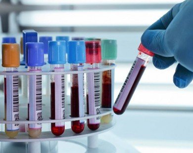 6 xét nghiệm máu cần làm trước 30 tuổi