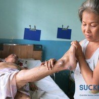 Hệ quả nghiêm trọng đối với người cao tuổi nằm liệt