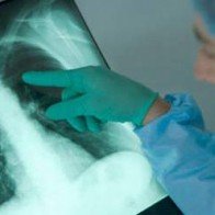 Ẩm ướt, coi chừng bệnh nấm phổi