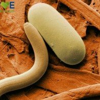 Những lưu ý khi sử dụng thuốc điều trị giun sán cho người cao tuổi