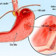 Ðề phòng nguy cơ xuất huyết do thuốc