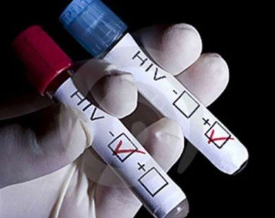 Công nghệ mới giúp phát hiện HIV chỉ sau 1 tuần phơi nhiễm