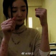 Đau lòng trước hình ảnh Dương Mịch bầm dập khắp người trong phim mới  