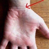 Dự đoán tương lai sướng khổ giàu nghèo qua đường vân cổ tay